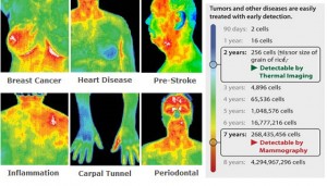 what is thermography